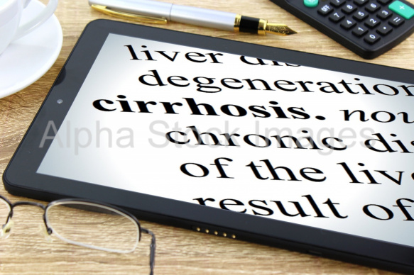 cirrhosis