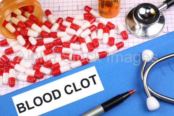 blood clot