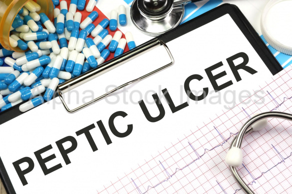 peptic ulcer
