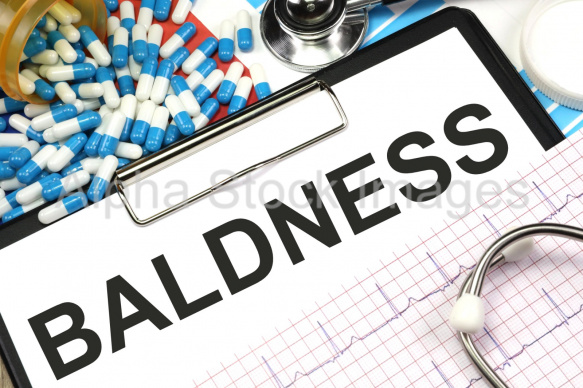 baldness