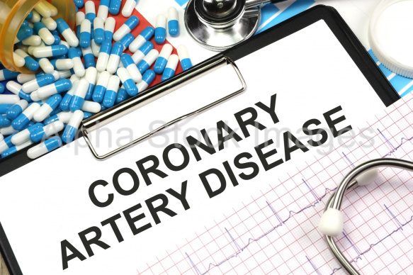 coronary artery disease