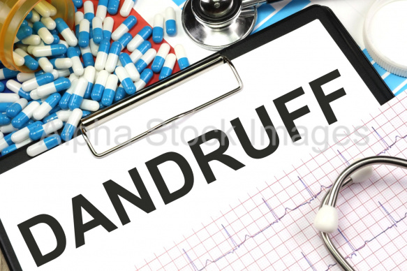 dandruff
