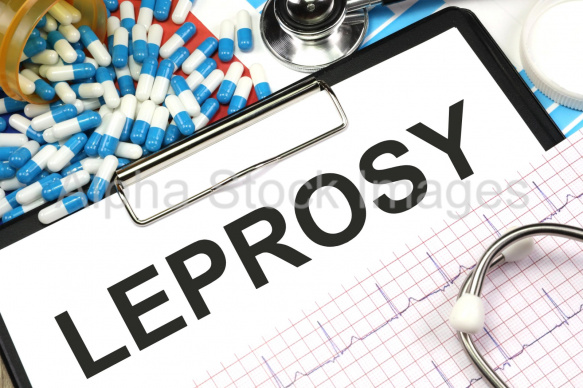 leprosy