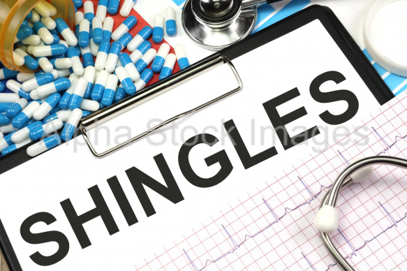 shingles
