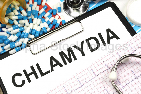 chlamydia