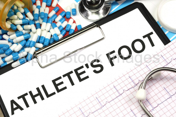 athletes foot