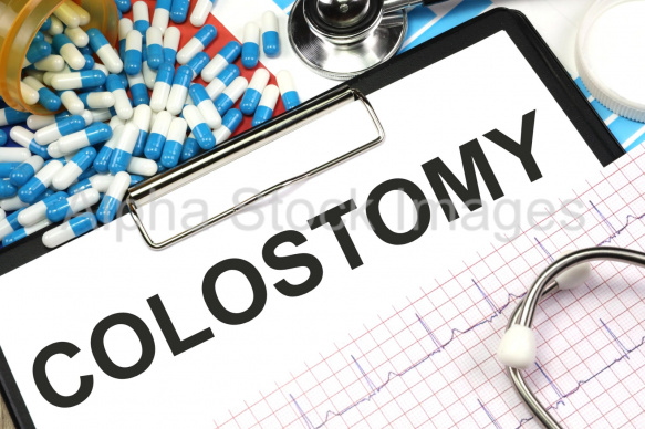 colostomy