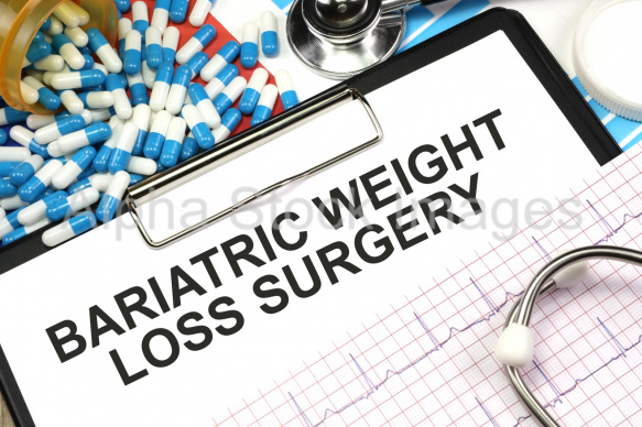 bariatric weight loss surgery