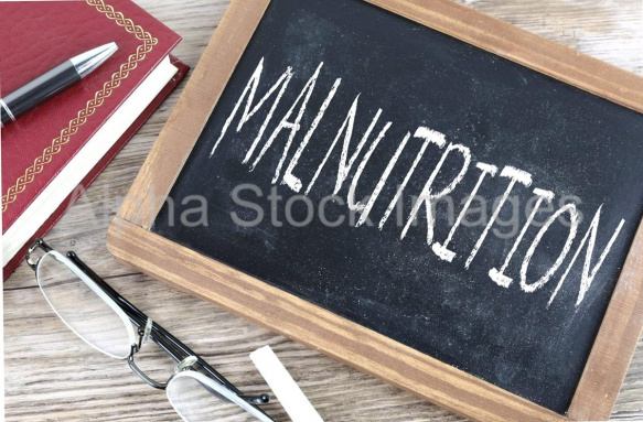 malnutrition