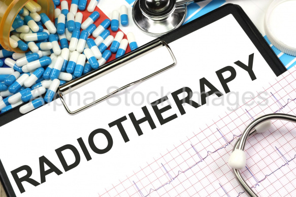 radiotherapy