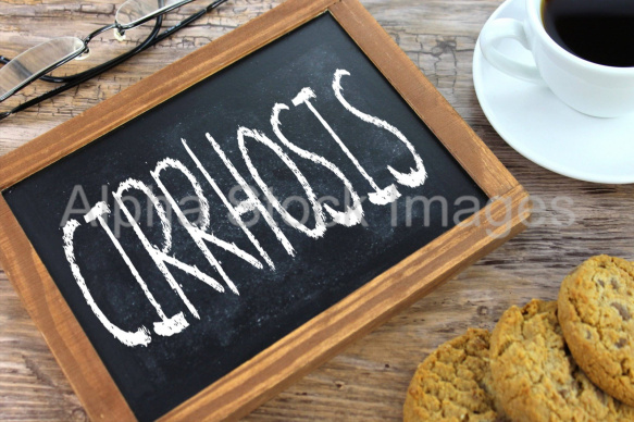 cirrhosis