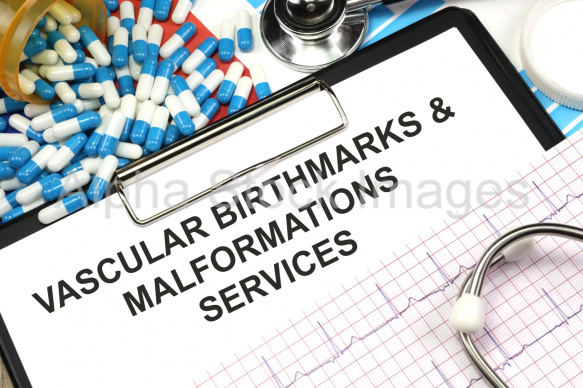 vascular birthmarks and malformations services