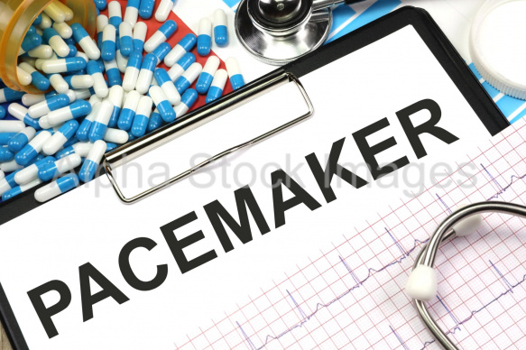 pacemaker