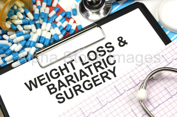 weight loss and bariatric surgery