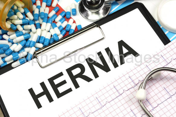 hernia