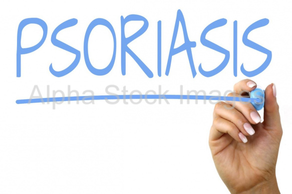 psoriasis