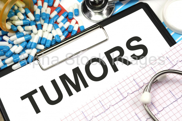 tumors