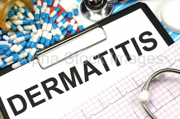 dermatitis