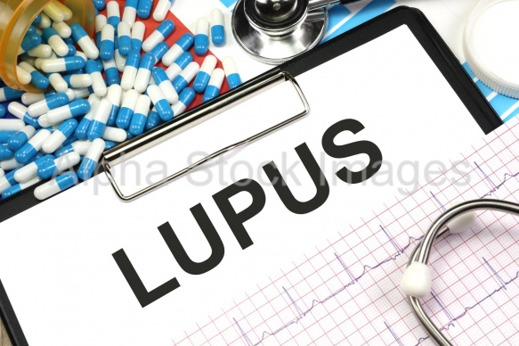 lupus