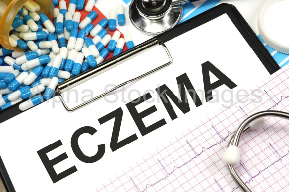 eczema
