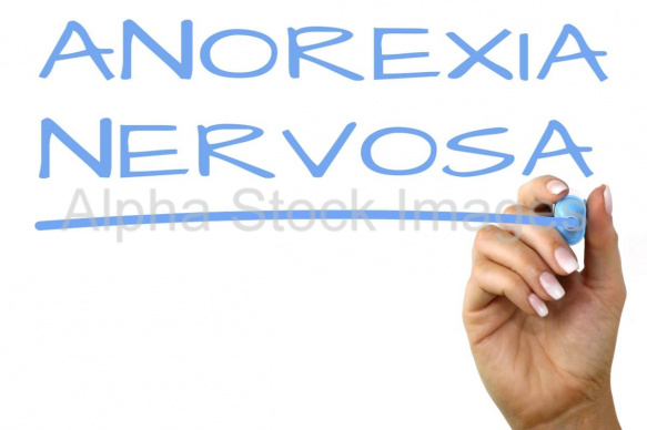 anorexia nervosa