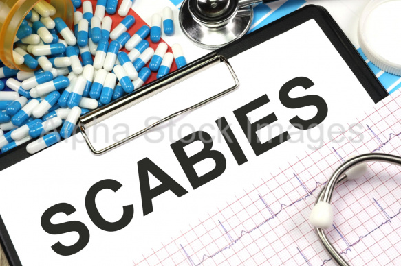 scabies