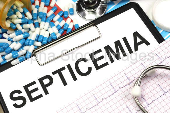 septicemia