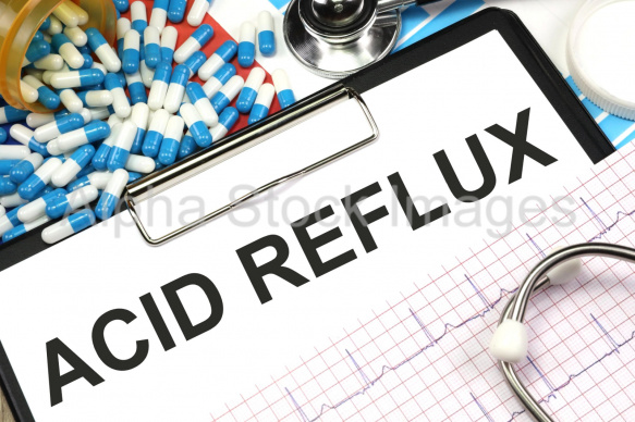 acid reflux