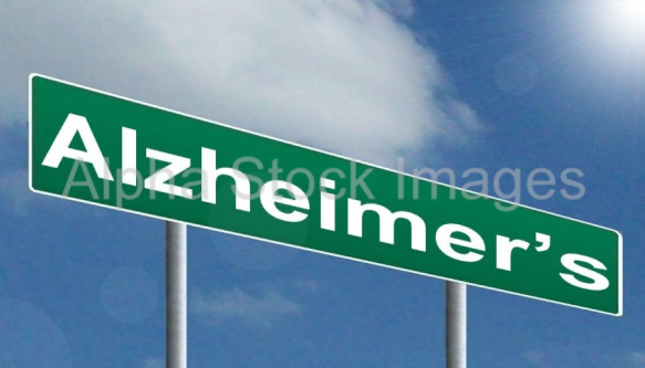 Alzheimer's