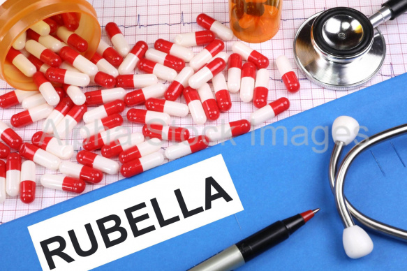 rubella