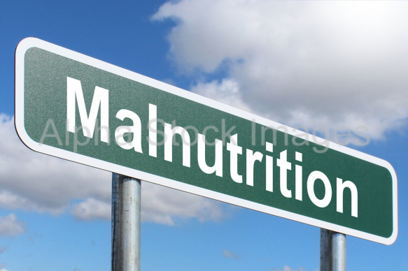 Malnutrition