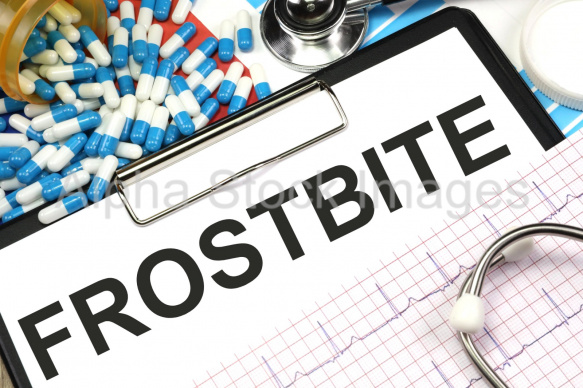frostbite