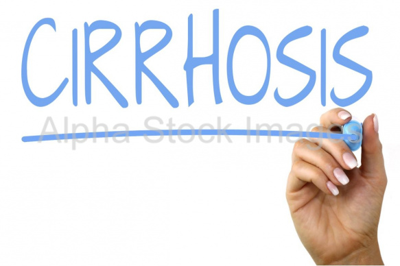 cirrhosis
