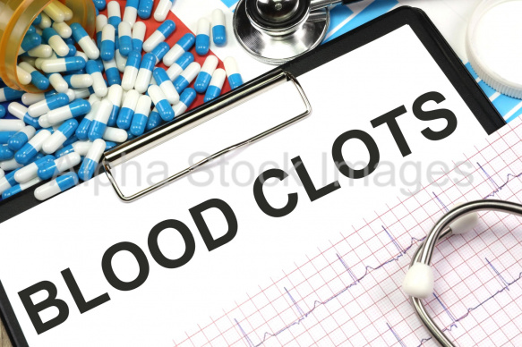 blood clots