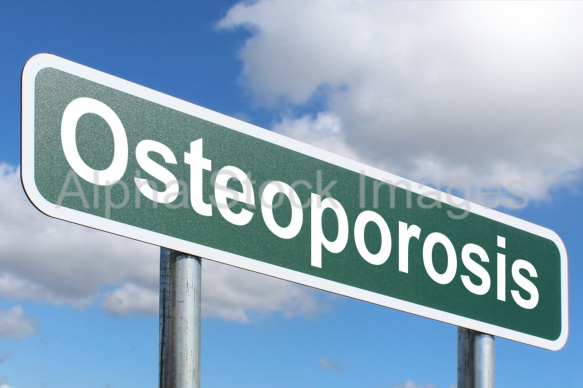 Osteoporosis