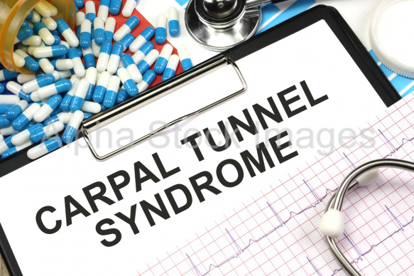 carpal tunnel syndrome