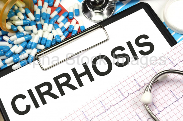 cirrhosis
