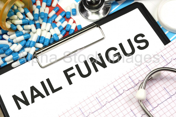 nail fungus