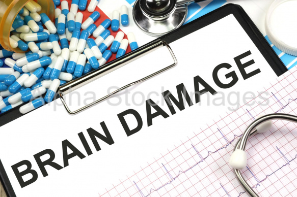 brain damage