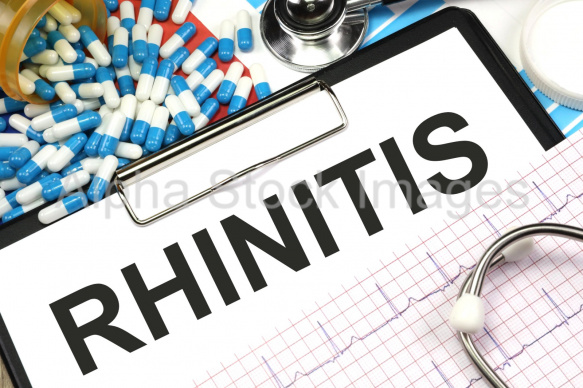 rhinitis