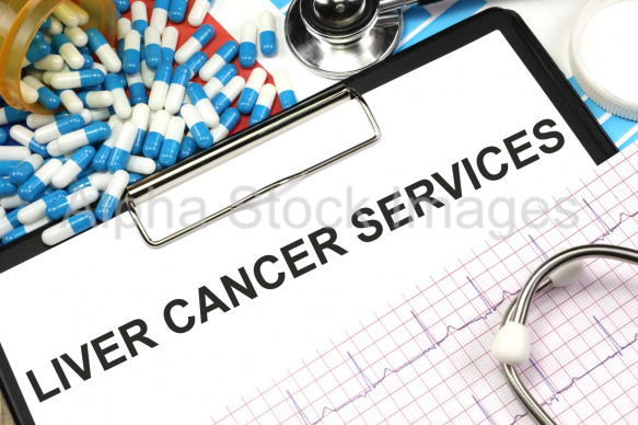 liver cancer services