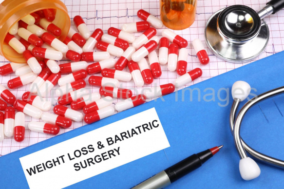 weight loss and bariatric surgery