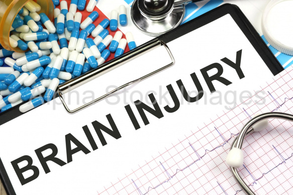 brain injury