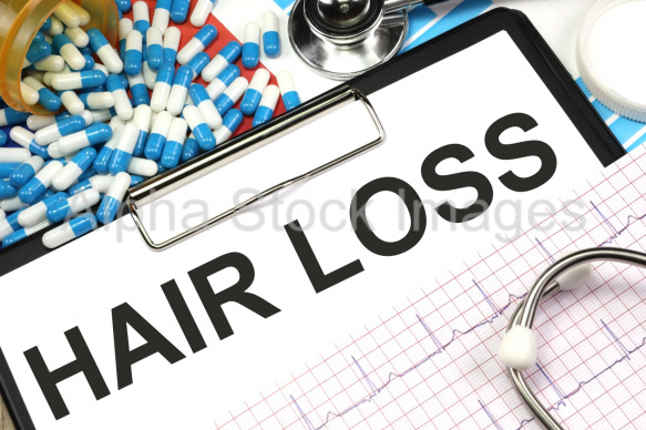 hair loss