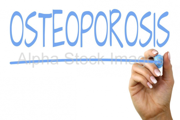 osteoporosis