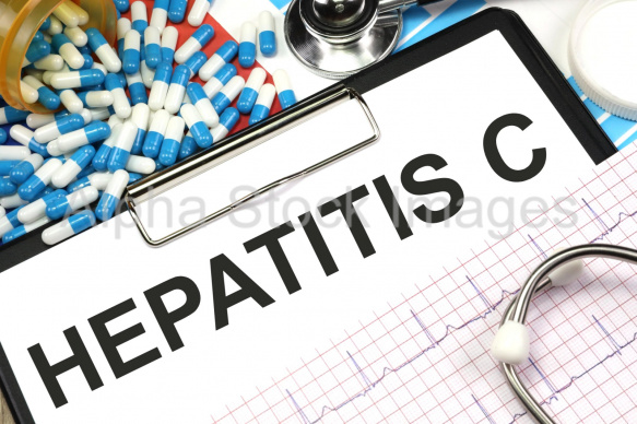 hepatitis c