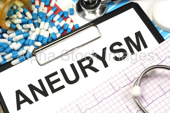 aneurysm
