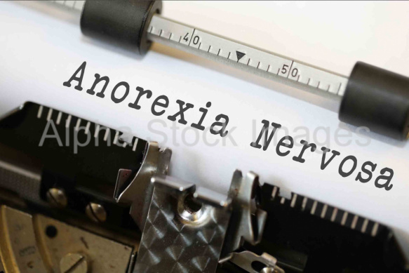Anorexia Nervosa