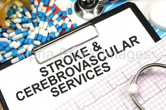 stroke and cerebrovascular services