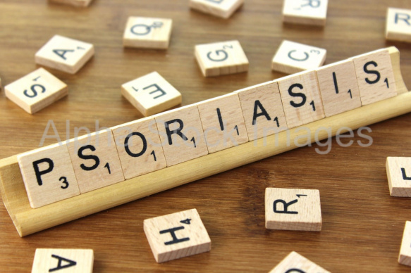 Psoriasis